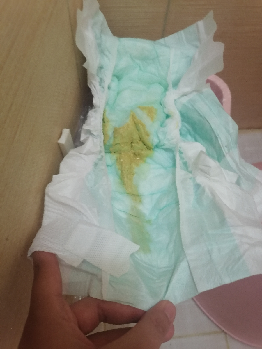 سلام وقت بخیر عکس مدفوع پسرم رو میزارم لطفا راهنمایی کنید که این عادی هست یا نه