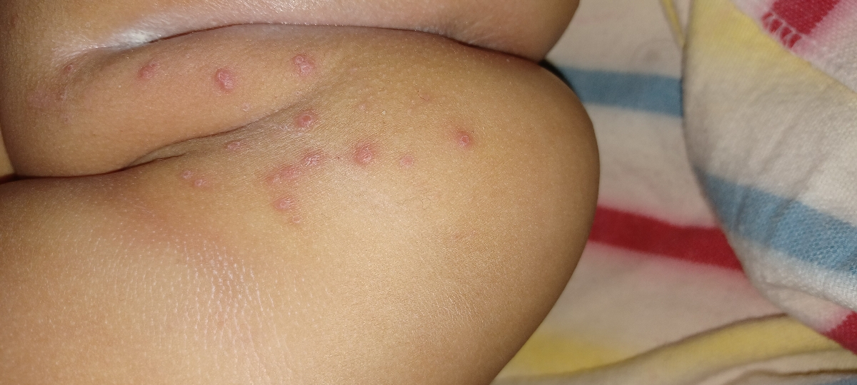 حالا اینطوری شده کرم ک زدم حالا اینطوری شده کرم ک زدم