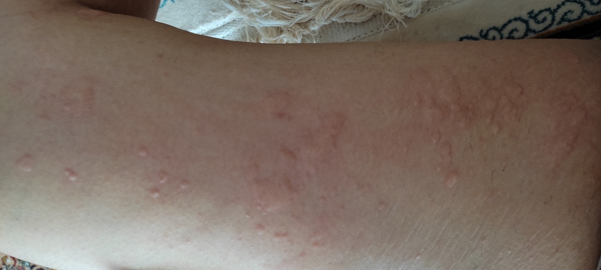سلام پزشک جان لطفا آزمایش من رو برسی کنین سلام پزشک جان لطفا آزمایش من رو برسی کنین