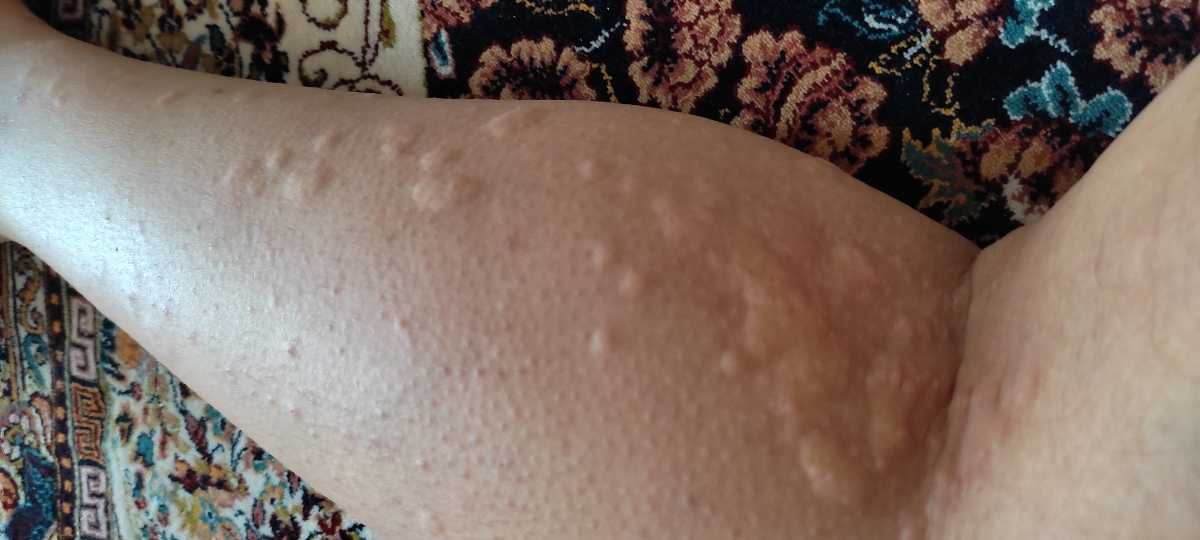 سلام پزشک جان لطفا آزمایش من رو برسی کنین سلام پزشک جان لطفا آزمایش من رو برسی کنین