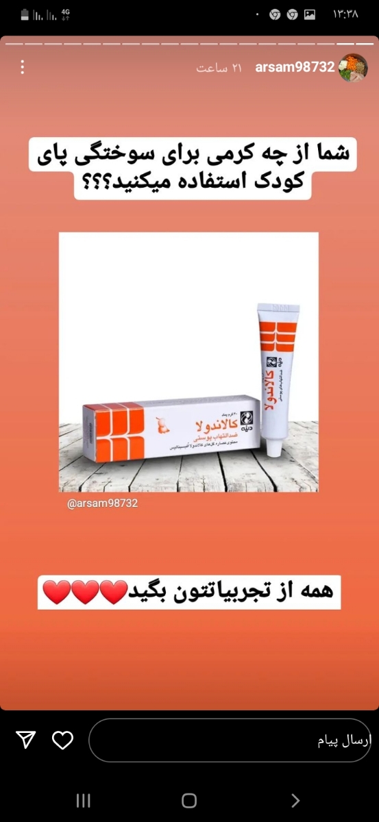 ادرار سوختگی شدید دختربچه ۱۰ ماهه ادرار سوختگی شدید دختربچه ۱۰ ماهه