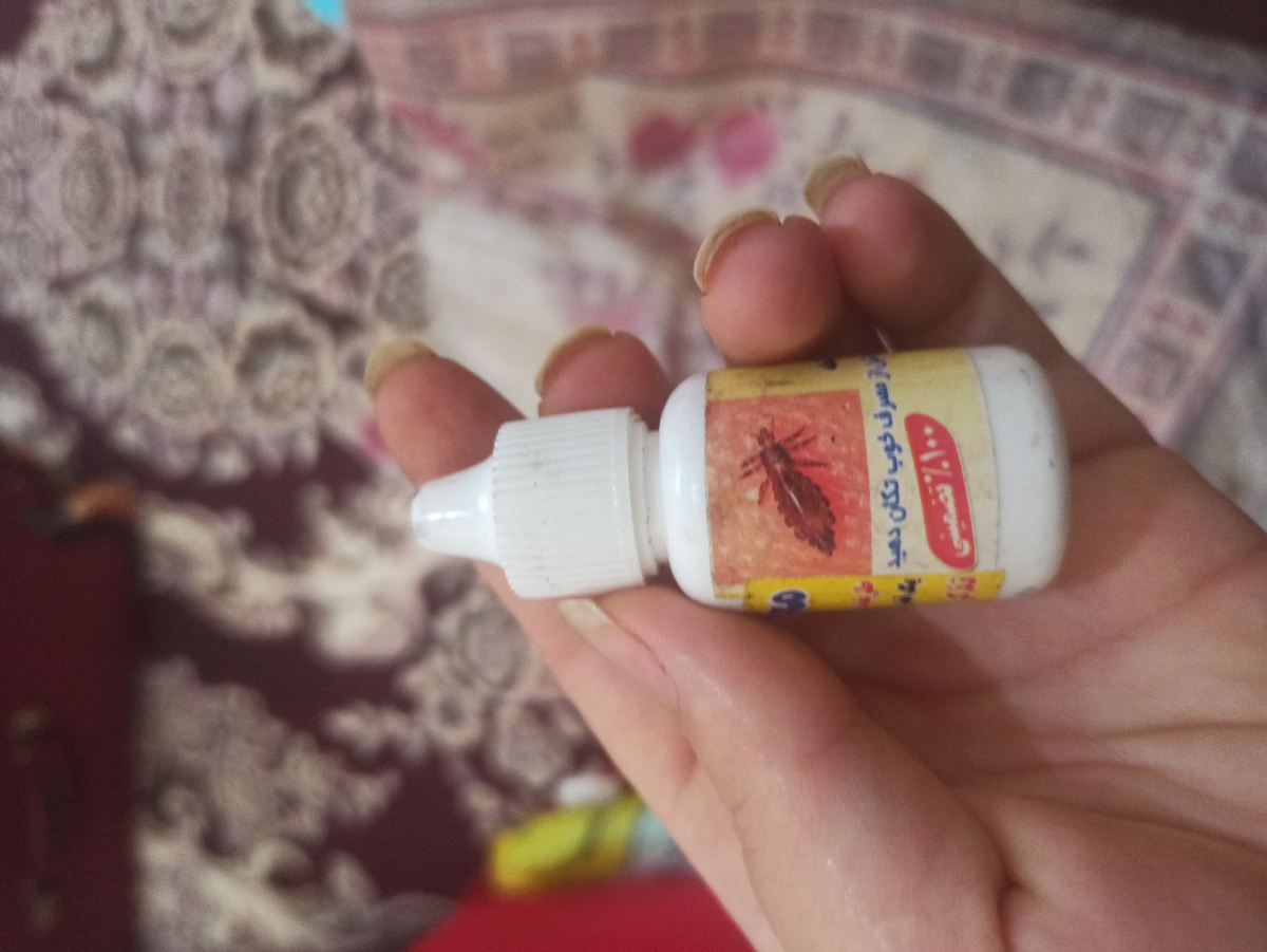 شپش سر دختر 2ساله 🤕🤕🤕 شپش سر دختر 2ساله 🤕🤕🤕