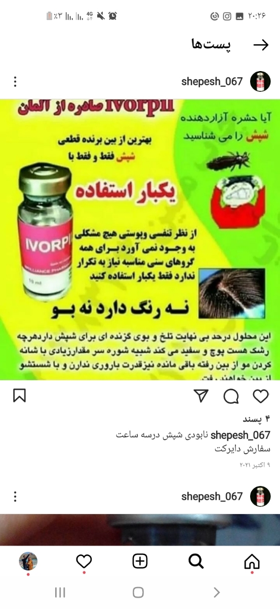 شپش سر دختر 2ساله 🤕🤕🤕 شپش سر دختر 2ساله 🤕🤕🤕