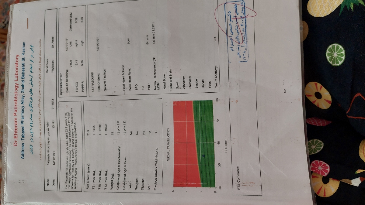 تفسیر سونو ان تی و دلیل غربالگری