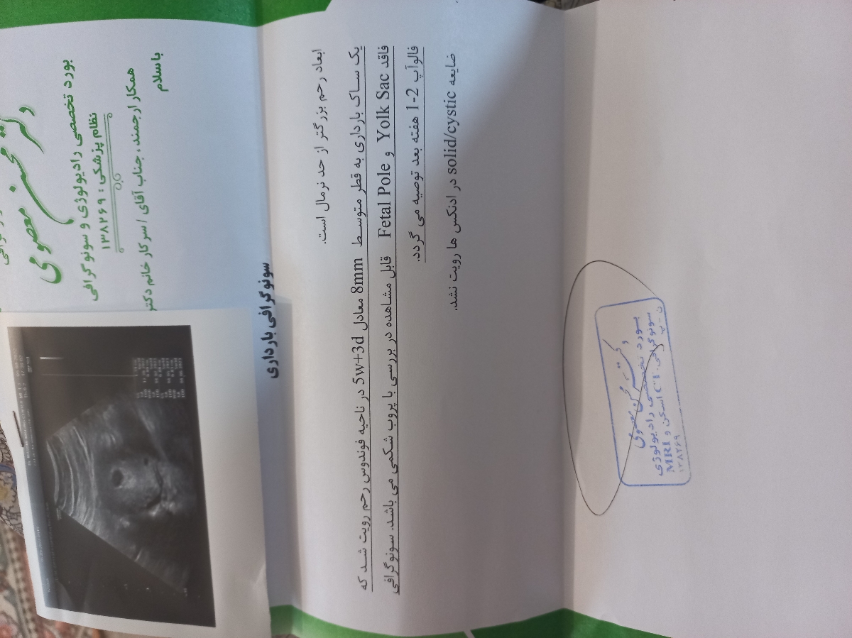 دیده نشدن جنین در ساک دیده نشدن جنین در ساک