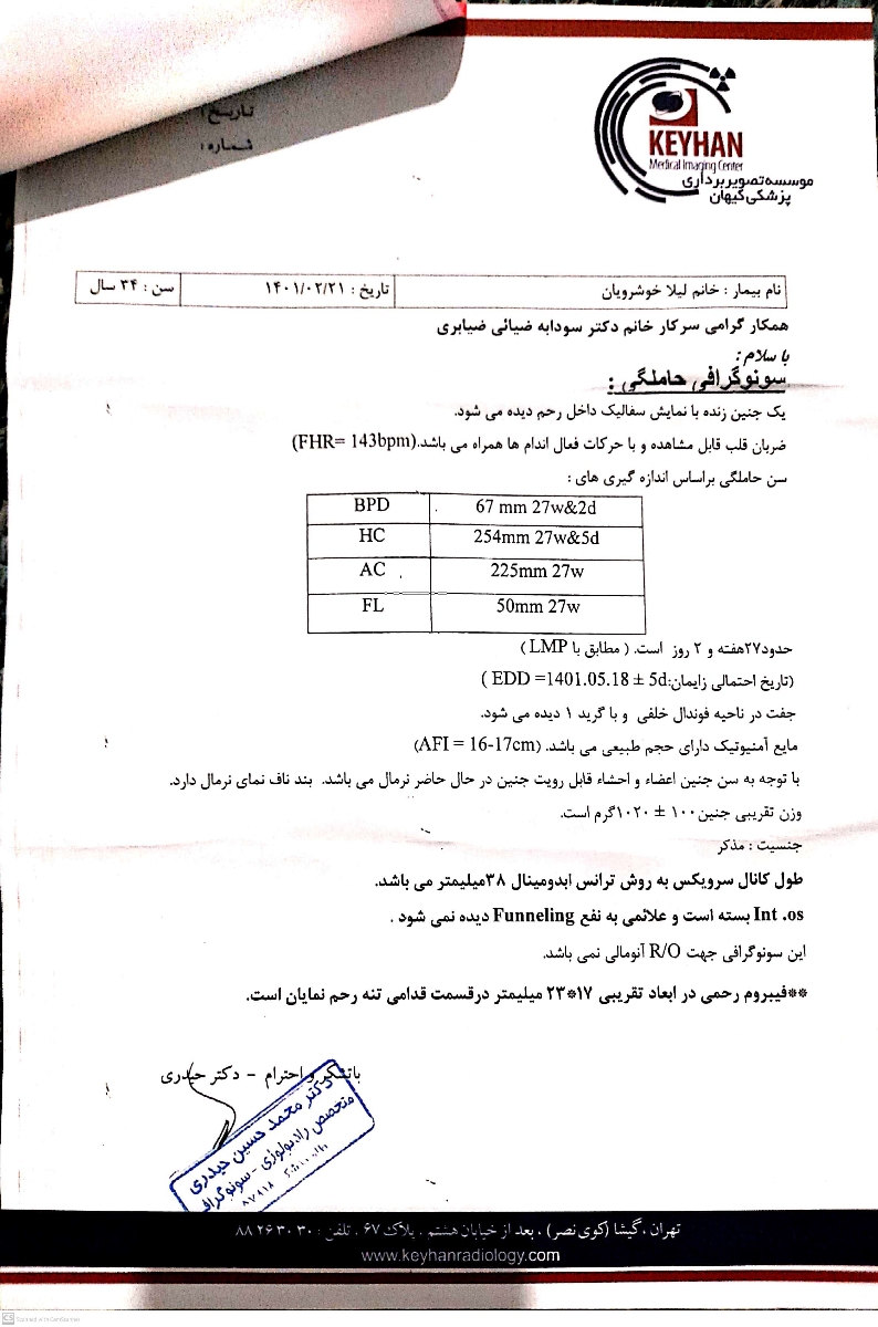 تفسیر سونو ۲۸ هفته