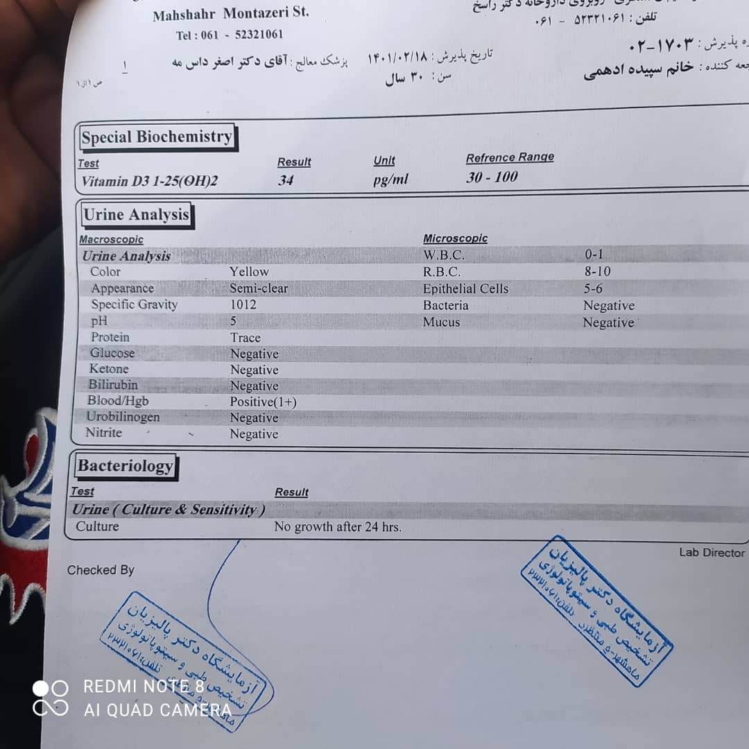 سونو وزن در ۳۰ هفته و ۴ روز سونو وزن در ۳۰ هفته و ۴ روز