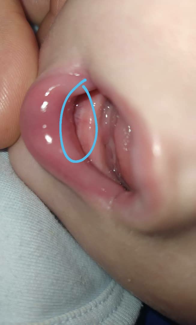 این یعنی بخاطر دندونه