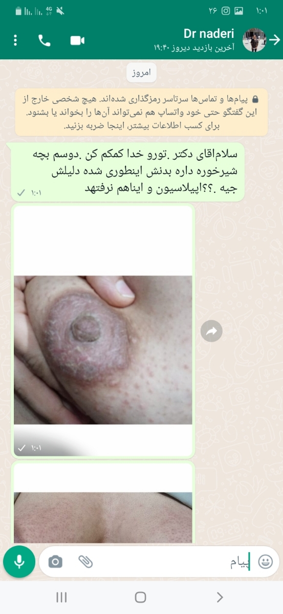 خارش شدید در کل بدن