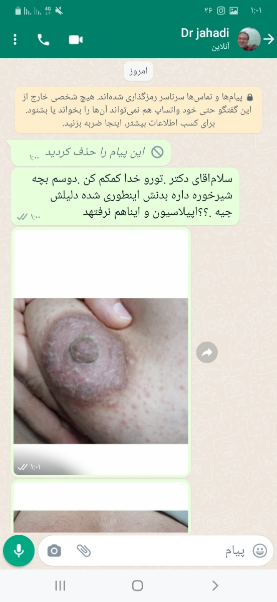 خارش شدید در کل بدن