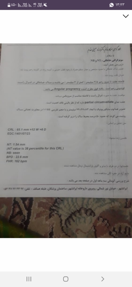 اینم سونو NT