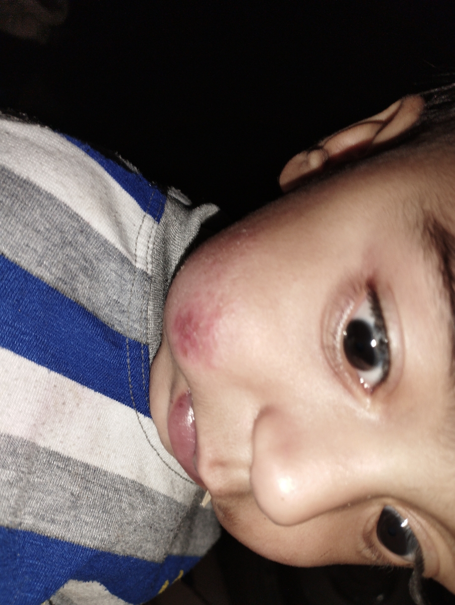 صورت نوزاد ۹ ماهه