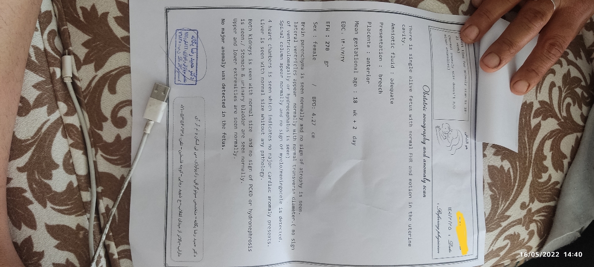 تفسیر سونو انومالی