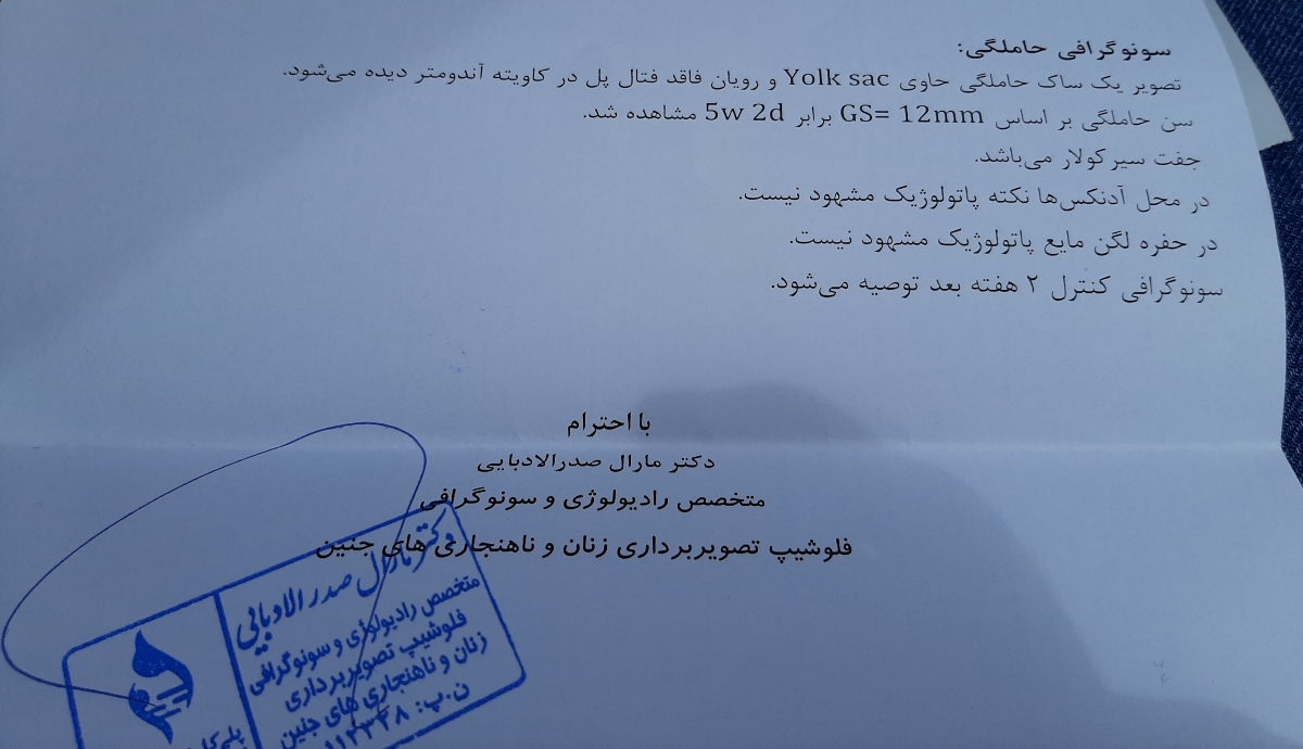 جفت سیرکولار فاقد فتال پل