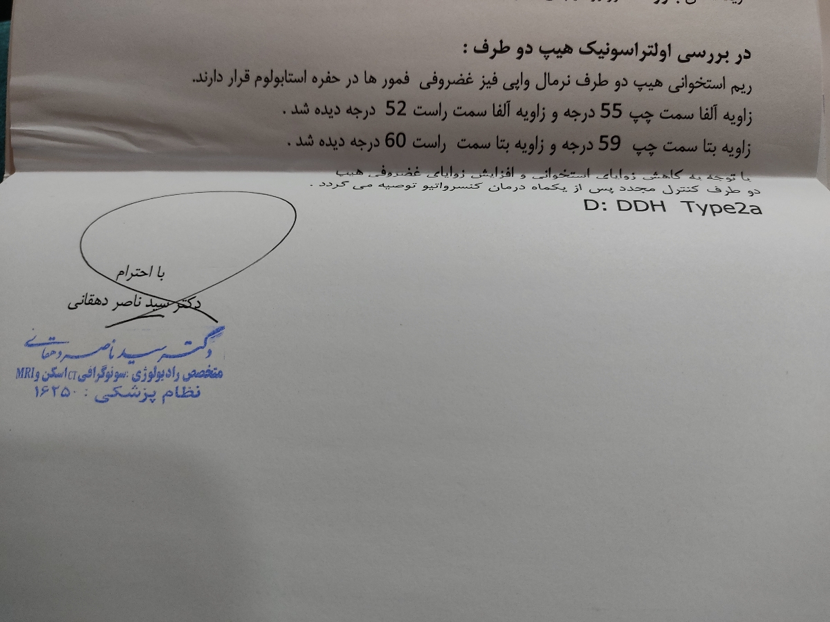 کوچک بودن لگن نوزاد