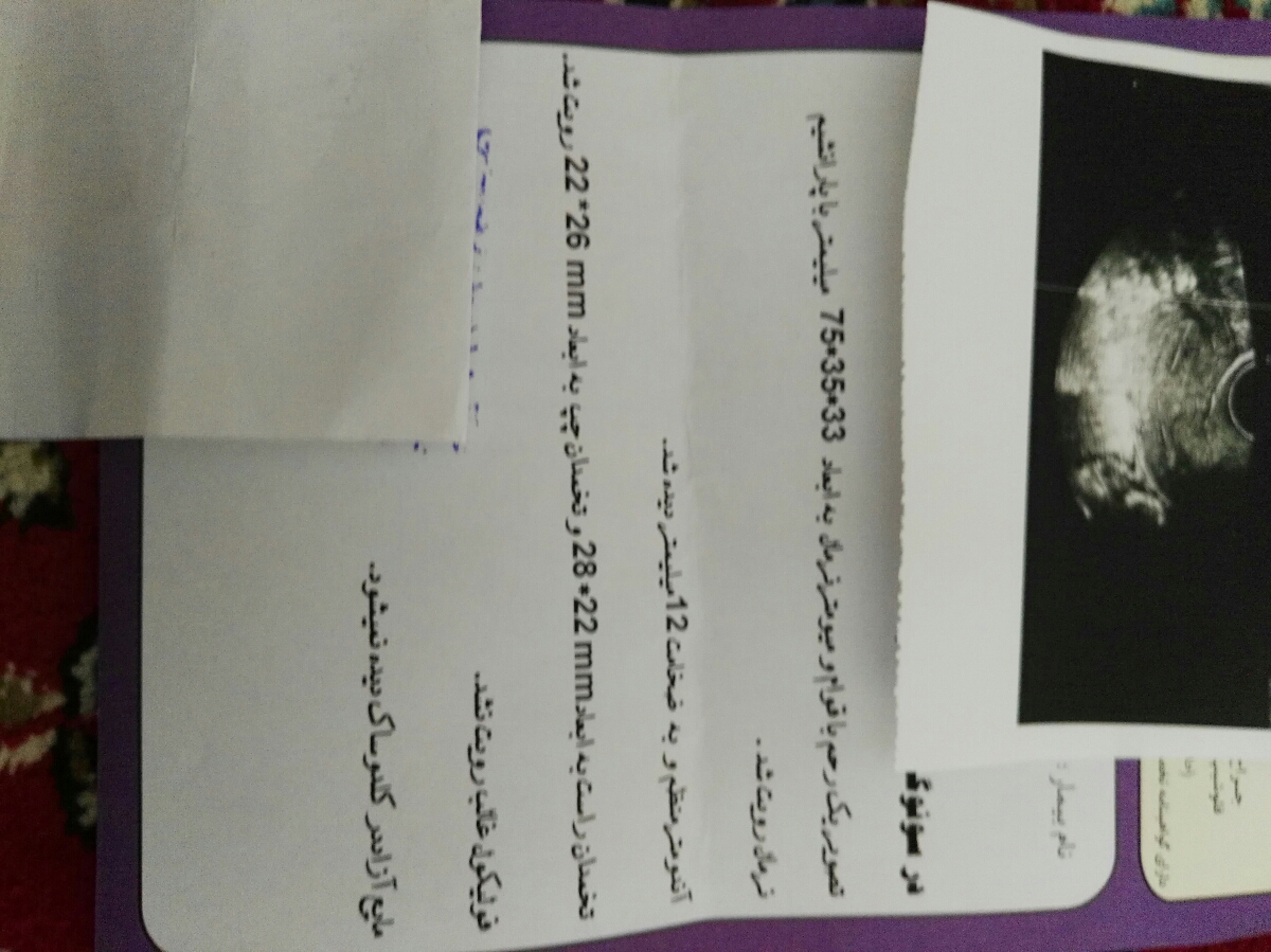 منظور از نداشتن فولیکول غالب ینی چی