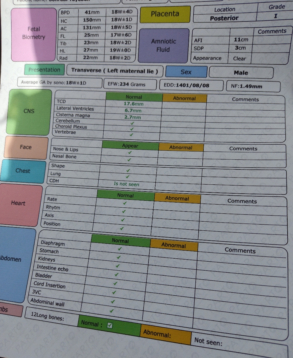جفت low lying در آنومالی