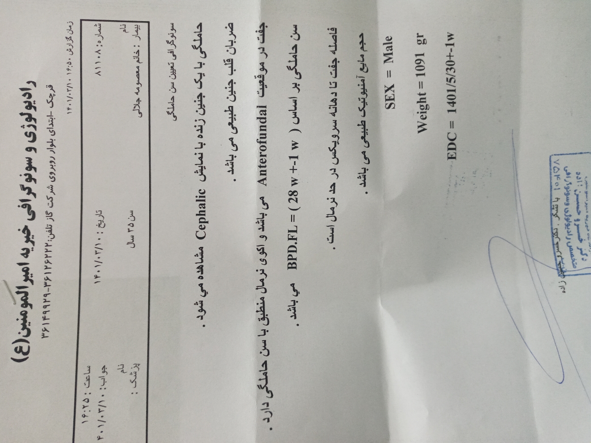 کمردرد شدید در هفته ۲۹