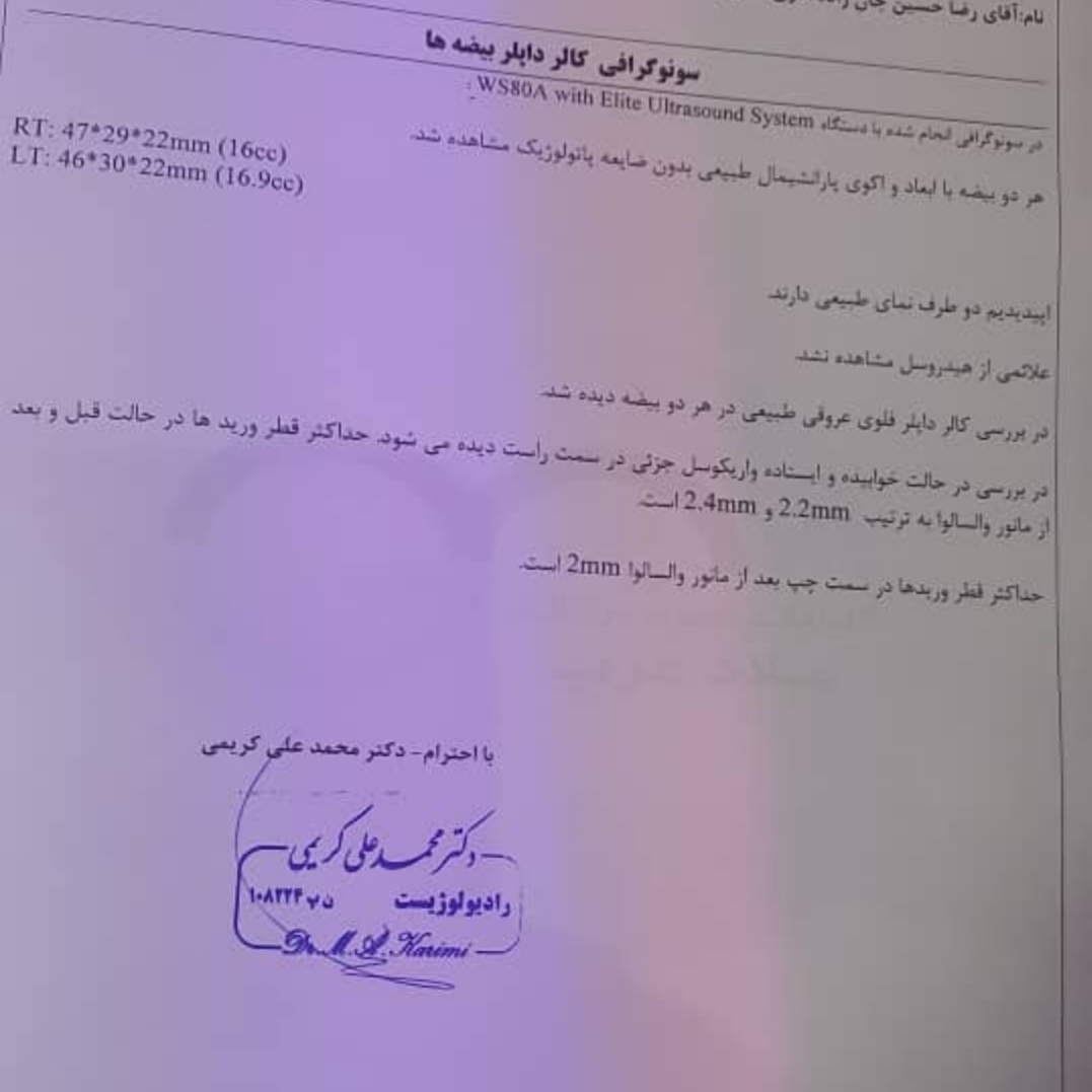 عمل واریکوسل و اقدام به بارداری