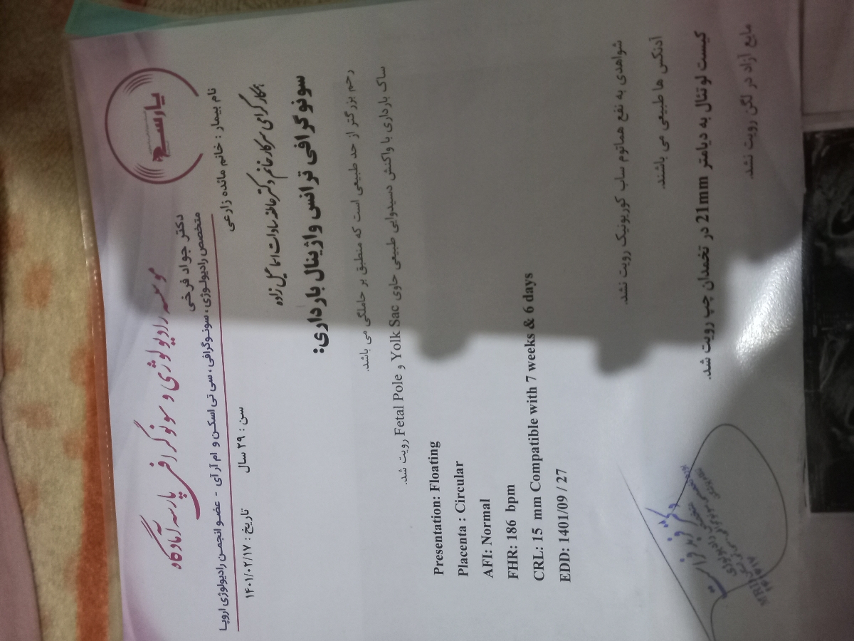 اینم دومی اینم دومی