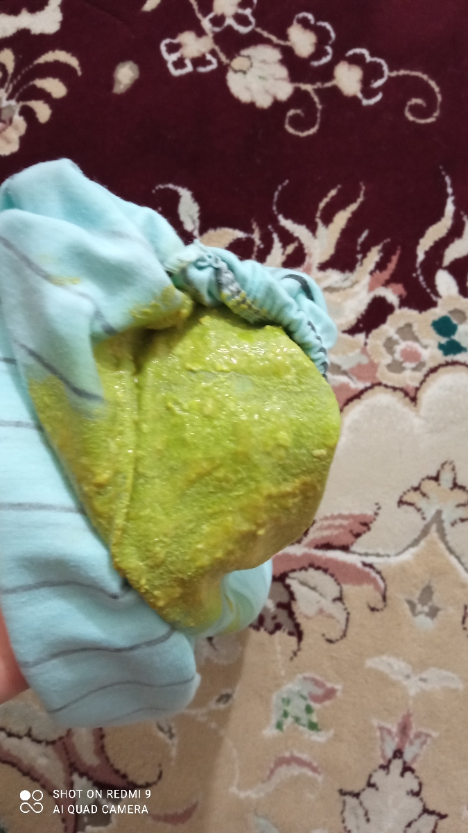 اسهال نوزاد سه ماهه