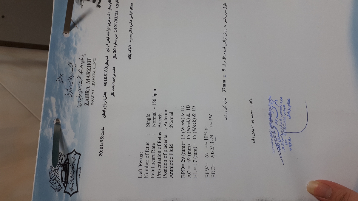 تفسیر سونو گرافی ۱۵ هفته