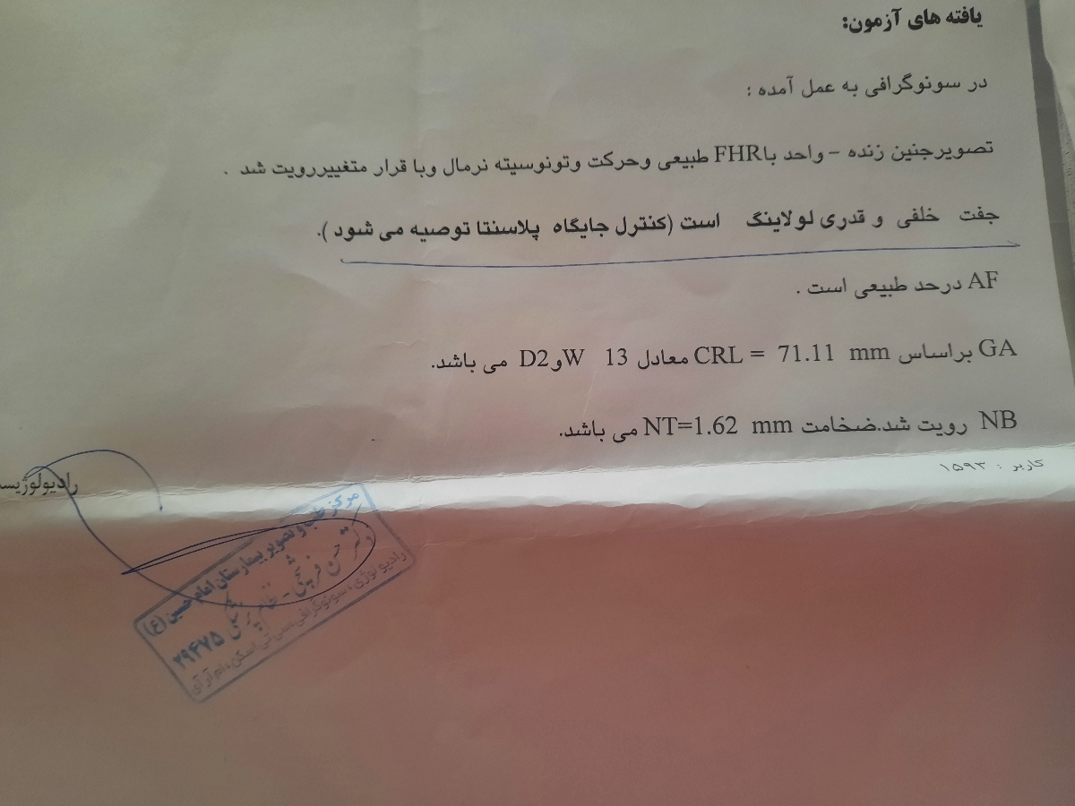 پایین بودن جفت