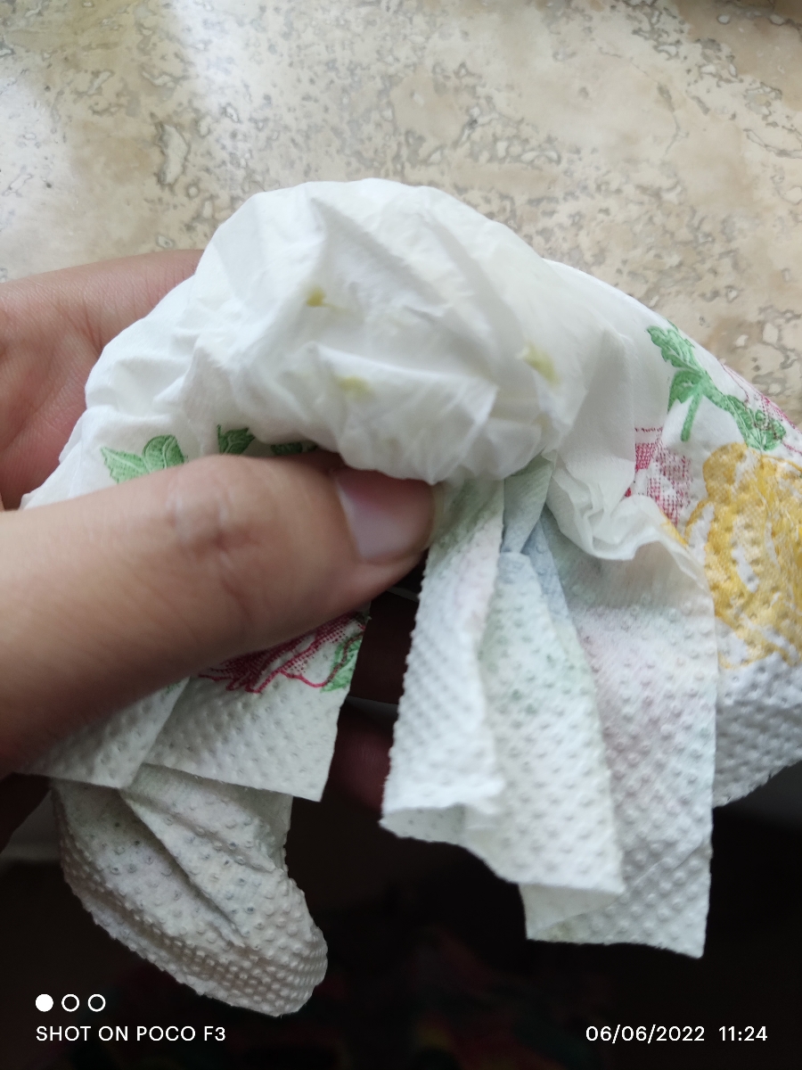 ترشحات رنگی در هفته 32 + عکس ترشحات رنگی در هفته 32 + عکس