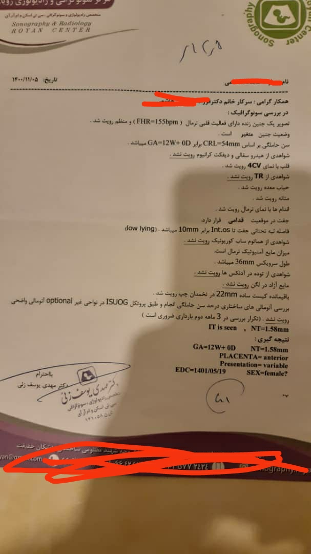 این سونو ان تی به تاریخ ۱۱/۵