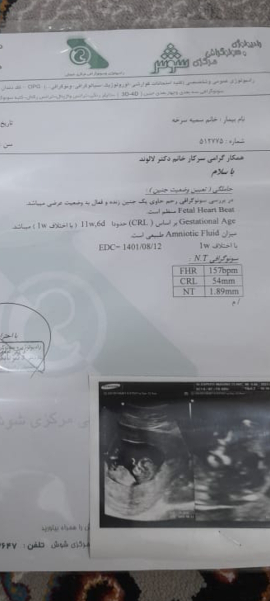 سونوگرافی ۱۹ هفته ‌‌‌‌
