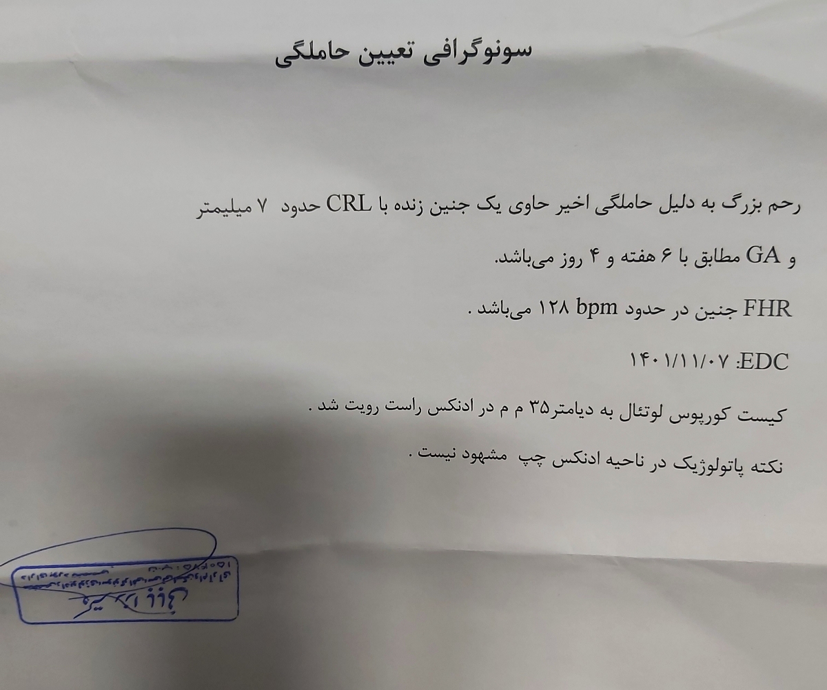 کیست کورپوس لوتئال کیست کورپوس لوتئال