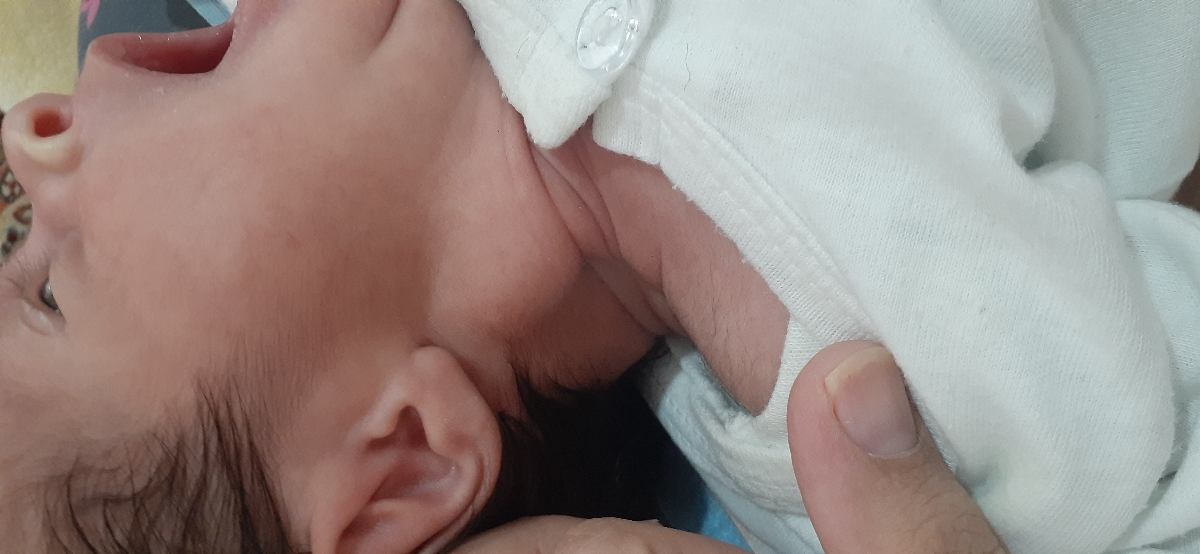 علت بوجود اومدن این برآمدگی