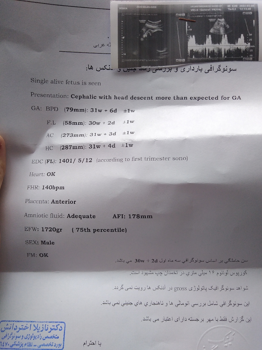 اینم سونو دو هفته پیش ک 30 هفته اس