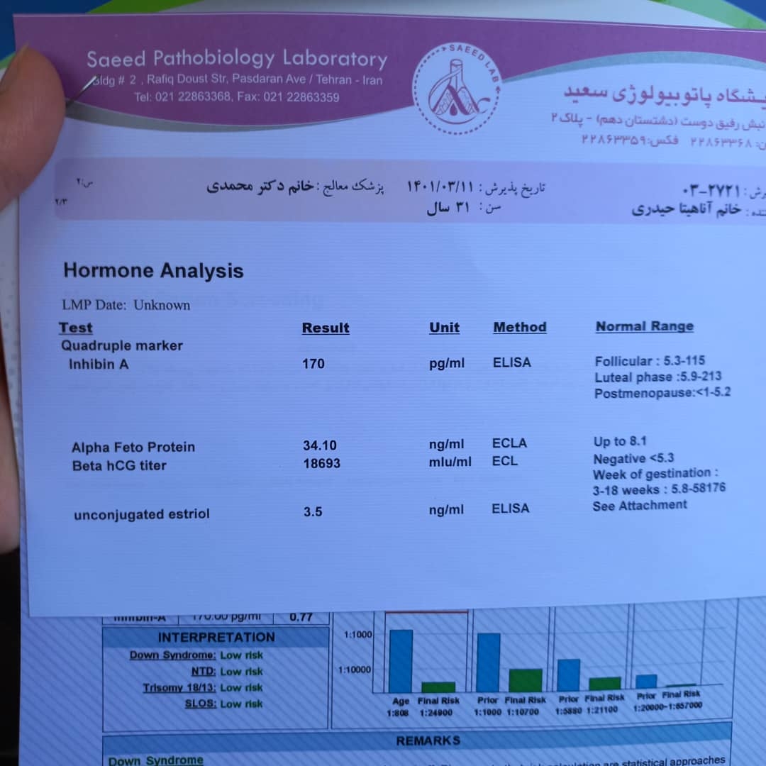 تفسیر آزمایش آنوملی دوستم