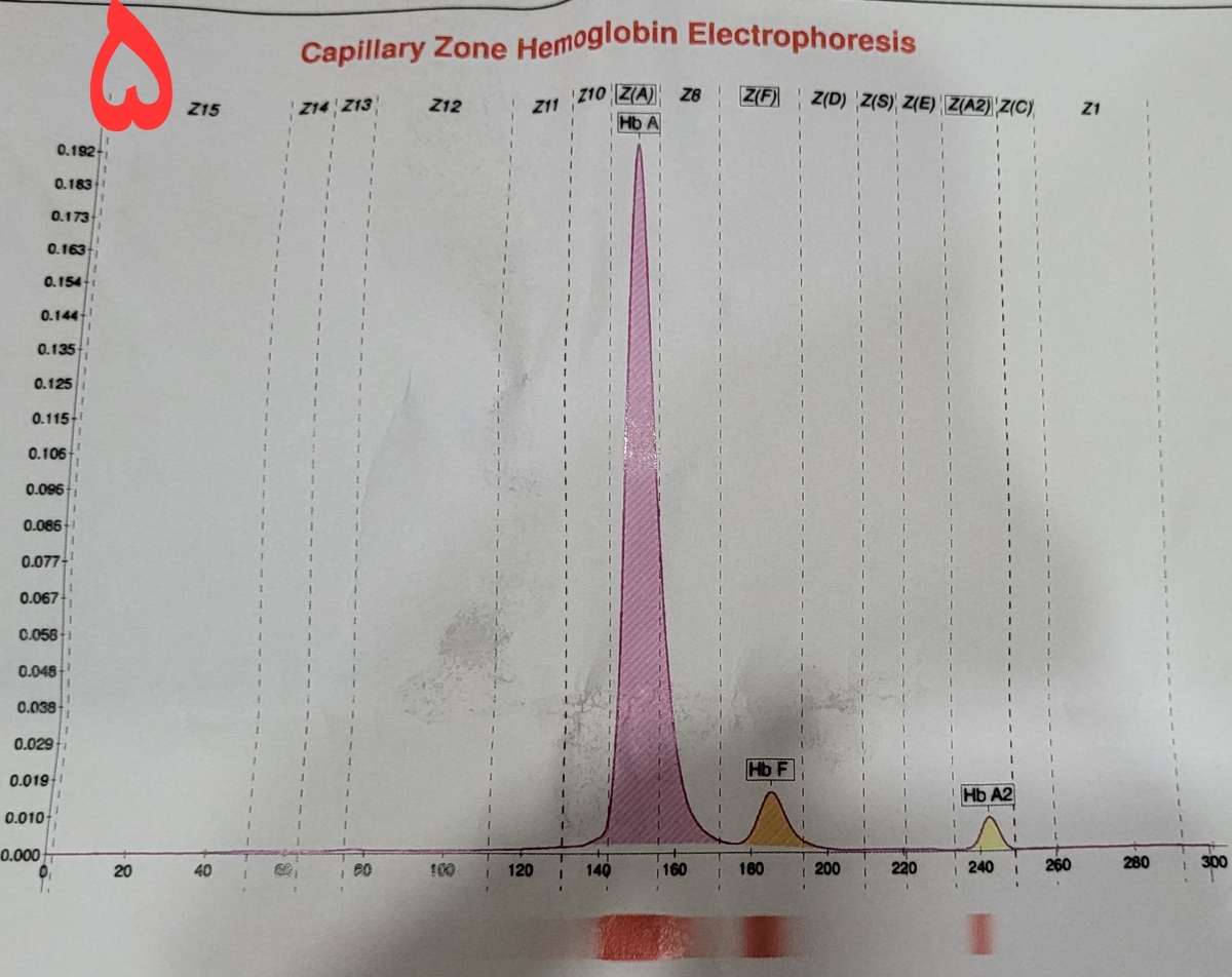 چکاپ یک سالگی کودک دختر