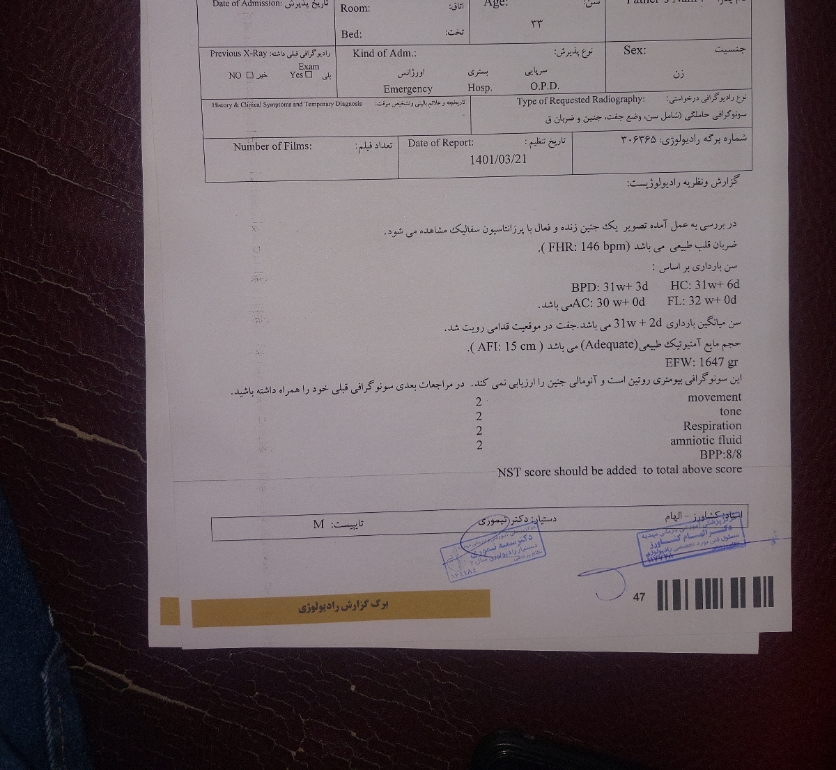 دل درد و اسهال