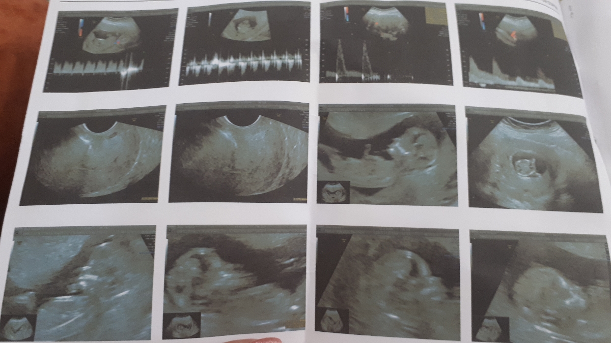 سلام سلام متخصصان تعیین جتسیت تشریف بیارید 😍😍👶🏻