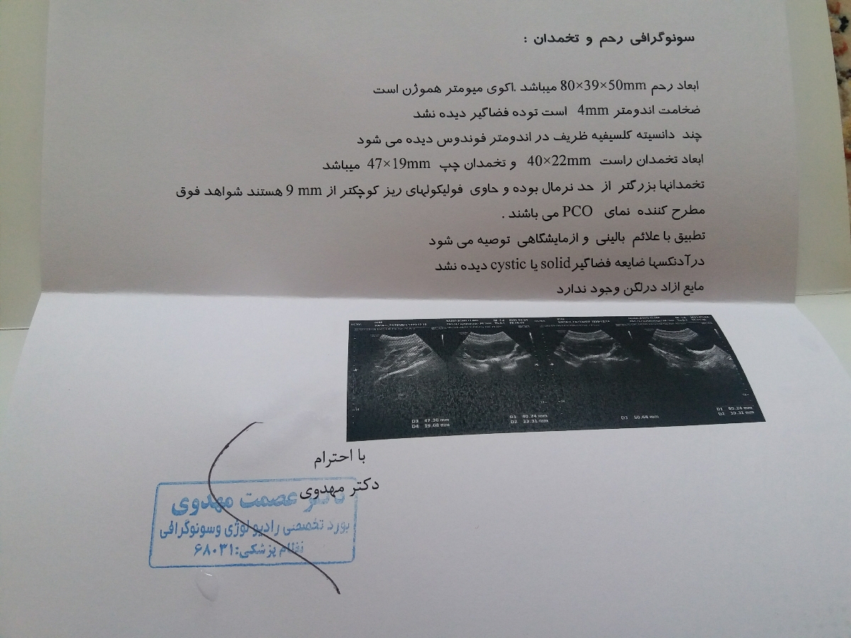 بررسی سونوگرافی رحم و تخمدان