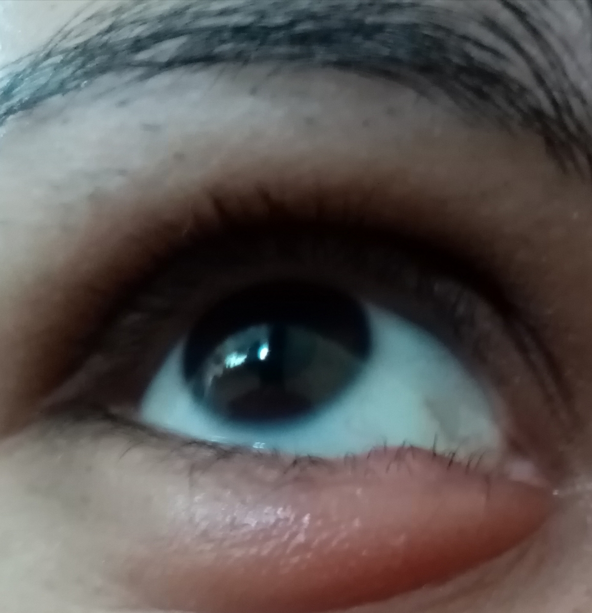 گل مژه و درمان سریع
