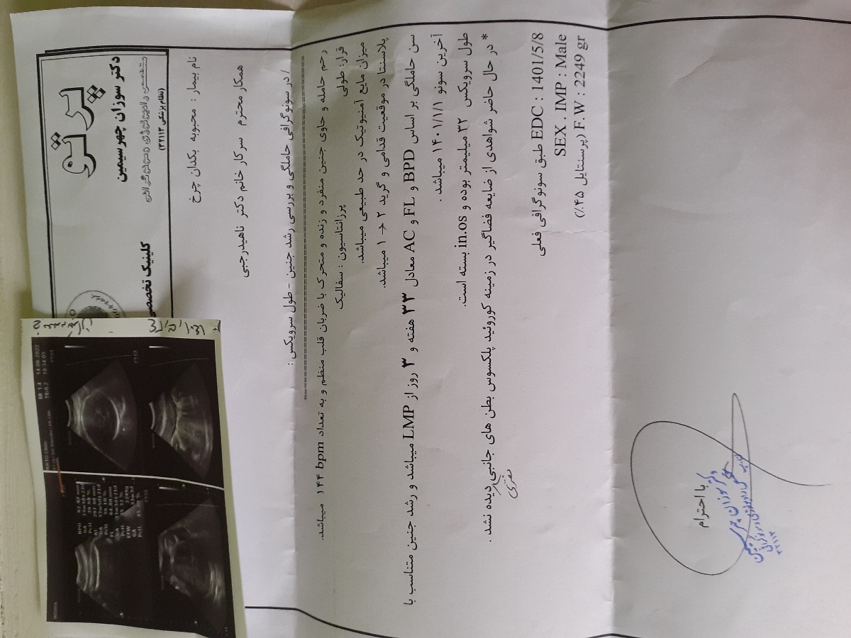 سونوگرافی در هفته ۳۳