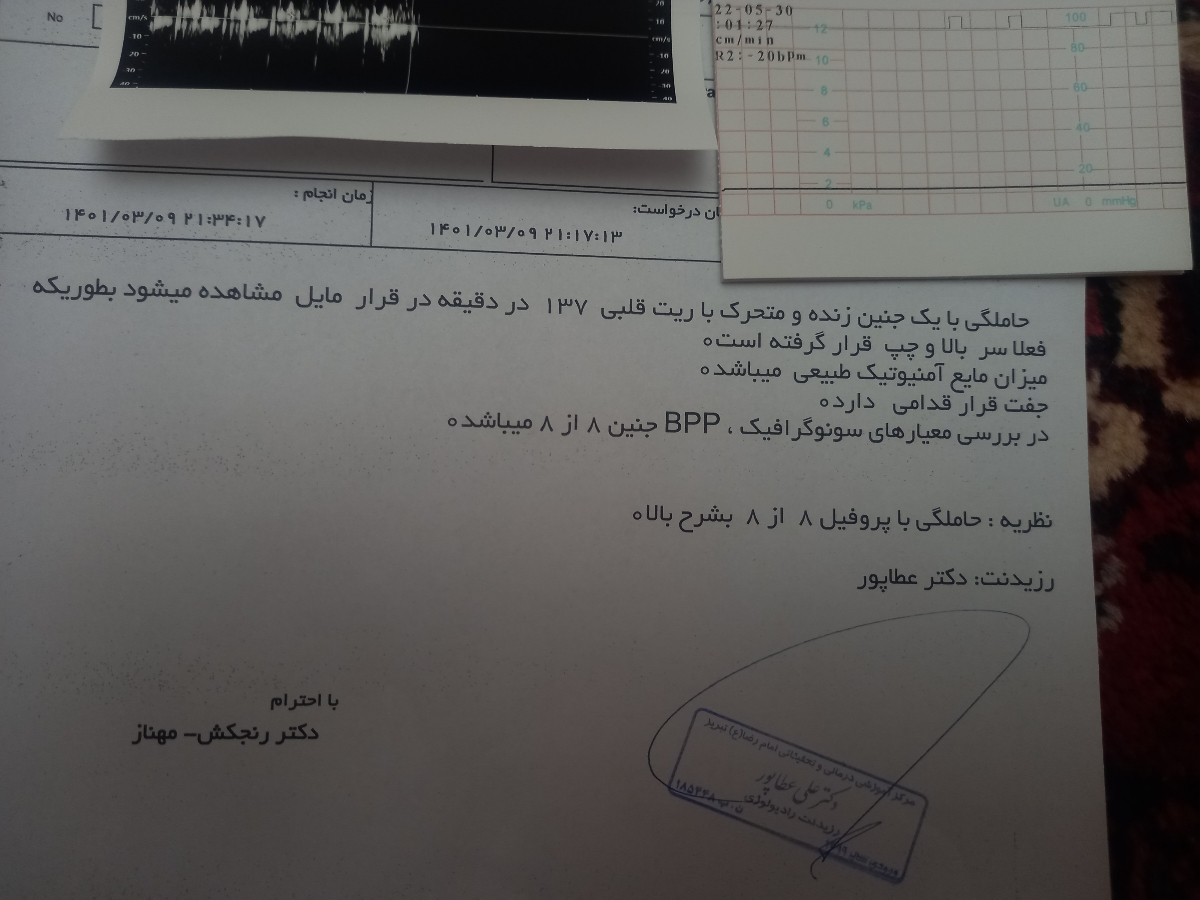 تفسیر آخرین سونوگرافی