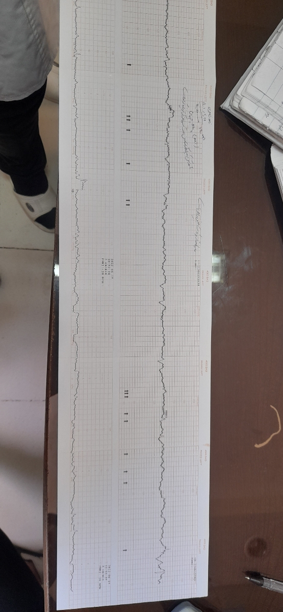 تفسیر نوار قلب جنین