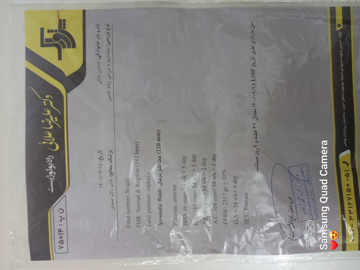 تفسیرازمایش تست تحمل گلوکزدرهفته۳۴بارداری