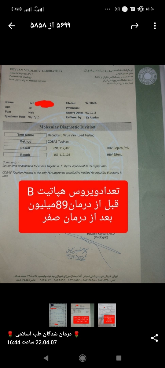 این قبلشه