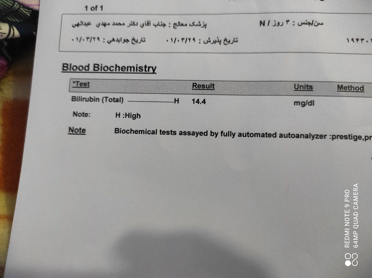 آزمایش دوم