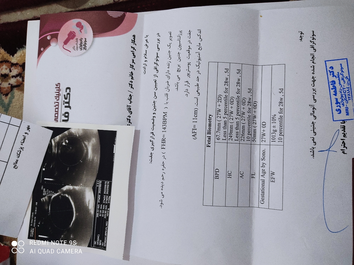 سونو ی دیروز قبل معمولی