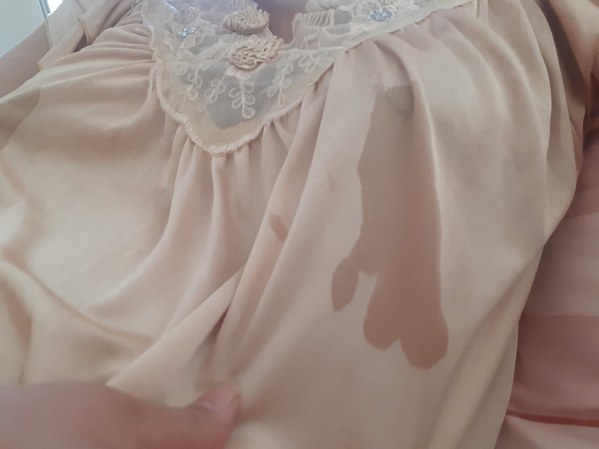 این حد ترشح عادیه؟؟؟؟ این حد ترشح عادیه؟؟؟؟