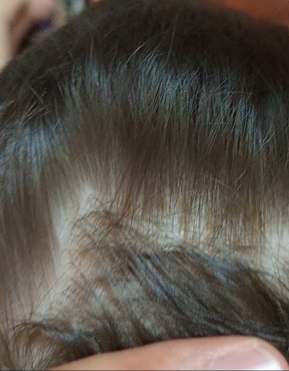 عکس از کف سرش عکس از کف سرش
