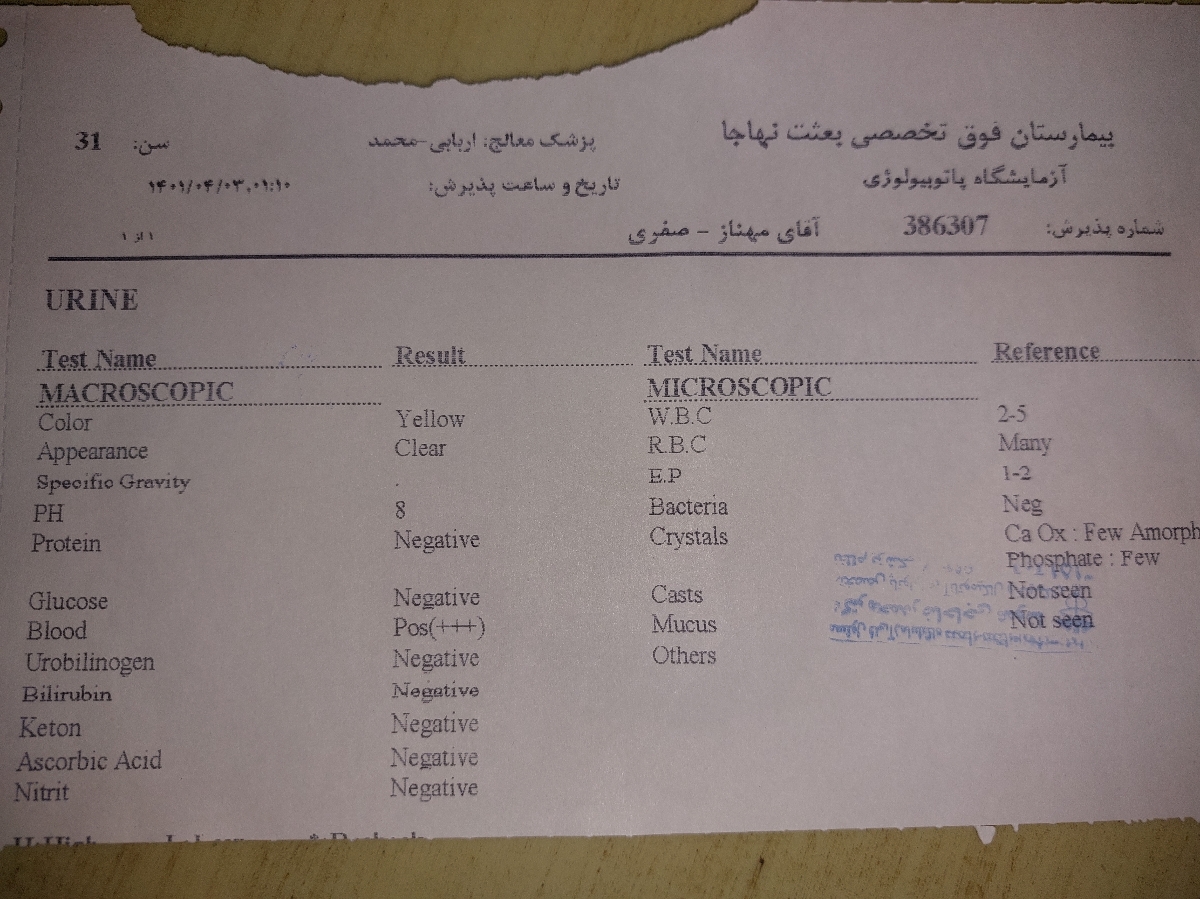 تفسیر آزمایش ادرار ۳۰ هفتگی