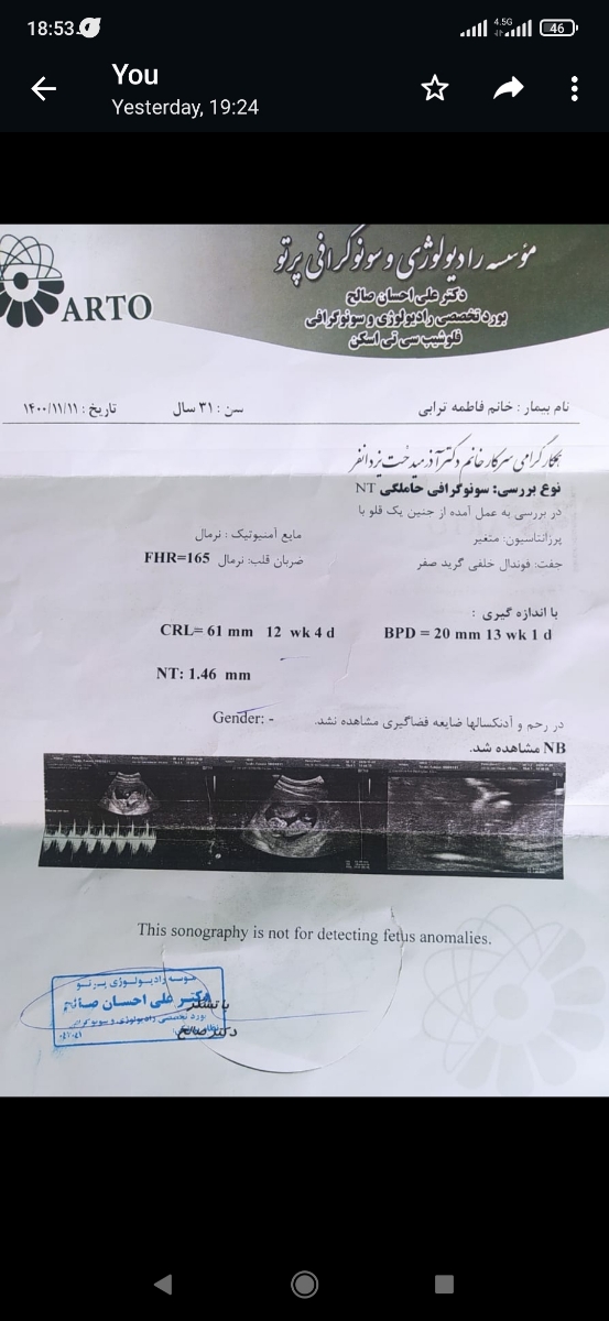 اینم سونوگرافیnt که 11بهمن دادم 